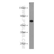 COX15 Rabbit Polyclonal Antibody (11441-1-AP)
