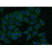 ARHGAP1 Rabbit Polyclonal Antibody (11169-1-AP)