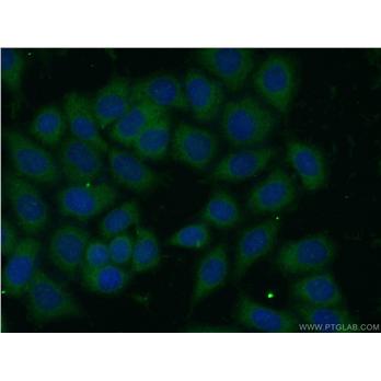 ARHGAP1 Rabbit Polyclonal Antibody (11169-1-AP)