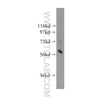 GTPBP2 Rabbit Polyclonal Antibody (11557-1-AP)