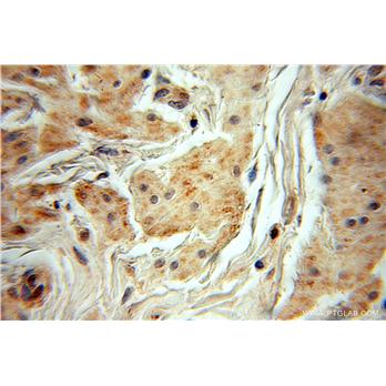 MYEOV Rabbit Polyclonal Antibody (11151-1-AP)