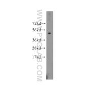 PPIL5 Rabbit Polyclonal Antibody (11628-1-AP)