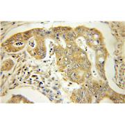 SEC61G Rabbit Polyclonal Antibody (11147-2-AP)