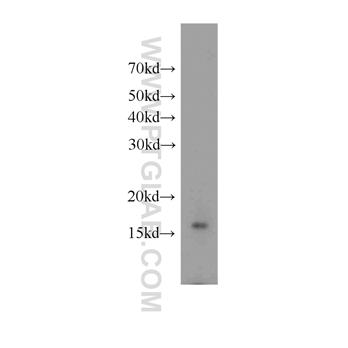 FKBP2 Rabbit Polyclonal Antibody (11700-1-AP)