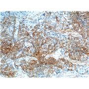 S100A10 Rabbit Polyclonal Antibody (11250-1-AP)