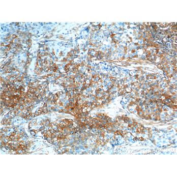 S100A10 Rabbit Polyclonal Antibody (11250-1-AP)