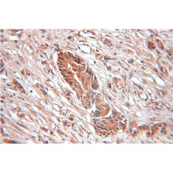 SRP9 Rabbit Polyclonal Antibody (11195-1-AP)