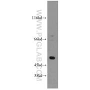 SESN3 Rabbit Polyclonal Antibody (11431-2-AP)