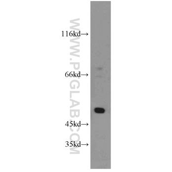 SESN3 Rabbit Polyclonal Antibody (11431-2-AP)