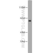 SP110 Rabbit Polyclonal Antibody (11502-1-AP)