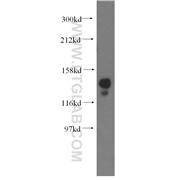 NASP Rabbit Polyclonal Antibody (11323-1-AP)
