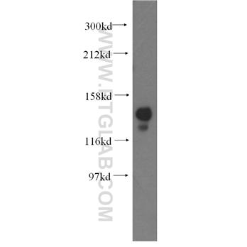 NASP Rabbit Polyclonal Antibody (11323-1-AP)