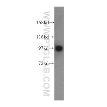 IPO13 Rabbit Polyclonal Antibody (11696-2-AP)
