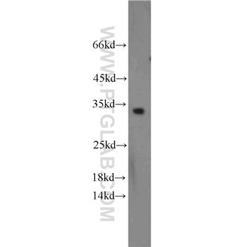 CDCA4 Rabbit Polyclonal Antibody (11625-1-AP)