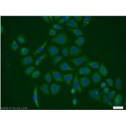 PPIH Rabbit Polyclonal Antibody (11651-1-AP)