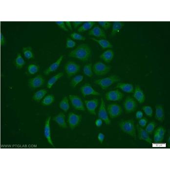 PPIH Rabbit Polyclonal Antibody (11651-1-AP)