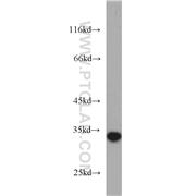 NT5C3 Rabbit Polyclonal Antibody (11393-1-AP)