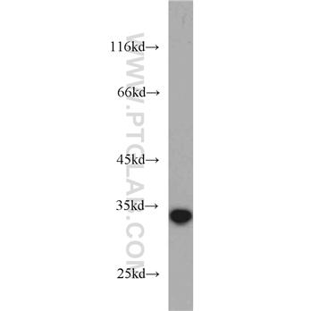 NT5C3 Rabbit Polyclonal Antibody (11393-1-AP)