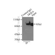 DGKA Rabbit Polyclonal Antibody (11547-1-AP)