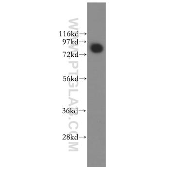 MCM5 Rabbit Polyclonal Antibody (11703-1-AP)