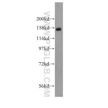 SYMPK Rabbit Polyclonal Antibody (11519-1-AP)