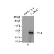 SEPSECS Rabbit Polyclonal Antibody (11551-1-AP)