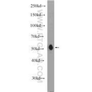 MFSD10 Rabbit Polyclonal Antibody (11518-1-AP)