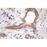 COX11 Rabbit Polyclonal Antibody (11498-1-AP)