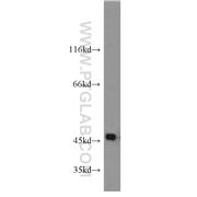 SPAM1 Rabbit Polyclonal Antibody (11208-1-AP)