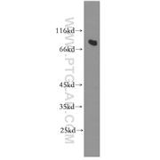 C19orf2 Rabbit Polyclonal Antibody (11277-1-AP)