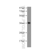ANKRD1 Rabbit Polyclonal Antibody (11427-1-AP)