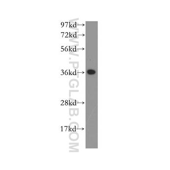 ANKRD1 Rabbit Polyclonal Antibody (11427-1-AP)