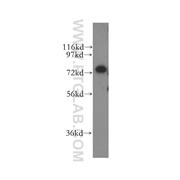 CPSF3 Rabbit Polyclonal Antibody (11609-1-AP)