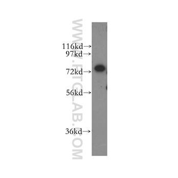 CPSF3 Rabbit Polyclonal Antibody (11609-1-AP)