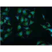 MED15 Rabbit Polyclonal Antibody (11566-1-AP)
