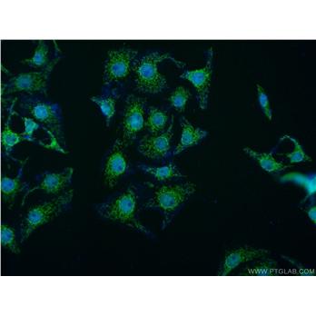 MED15 Rabbit Polyclonal Antibody (11566-1-AP)