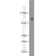 BRSK2 Rabbit Polyclonal Antibody (11589-1-AP)