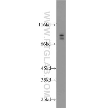 BRSK2 Rabbit Polyclonal Antibody (11589-1-AP)