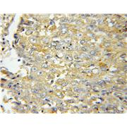 MGRN1 Rabbit Polyclonal Antibody (11285-1-AP)
