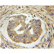 TIMM17A Rabbit Polyclonal Antibody (11189-1-AP)