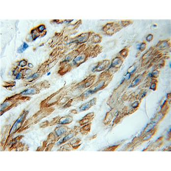 RP1-21O18.1 Rabbit Polyclonal Antibody (11572-1-AP)