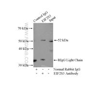EIF2S3 Rabbit Polyclonal Antibody (11162-1-AP)