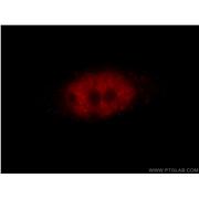 ZBTB7B Rabbit Polyclonal Antibody (11341-1-AP)