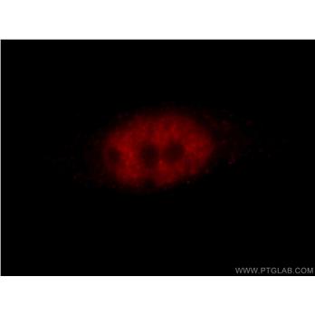 ZBTB7B Rabbit Polyclonal Antibody (11341-1-AP)