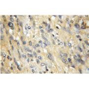 EXOC1 Rabbit Polyclonal Antibody (11690-1-AP)