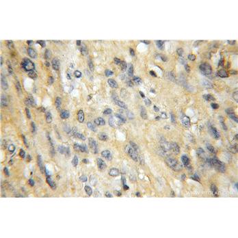 EXOC1 Rabbit Polyclonal Antibody (11690-1-AP)