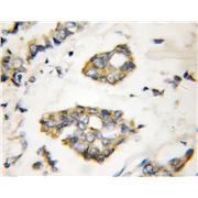 ERRFI1 Rabbit Polyclonal Antibody (11630-1-AP)
