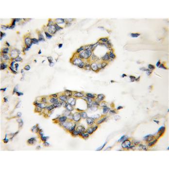 ERRFI1 Rabbit Polyclonal Antibody (11630-1-AP)