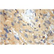PREP Rabbit Polyclonal Antibody (11536-1-AP)