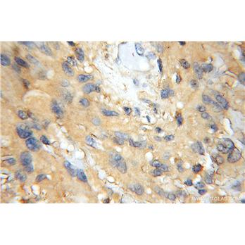 PREP Rabbit Polyclonal Antibody (11536-1-AP)
